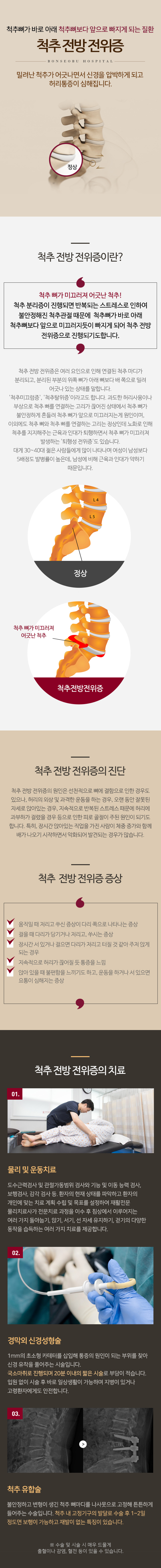 척추 전방 전위증