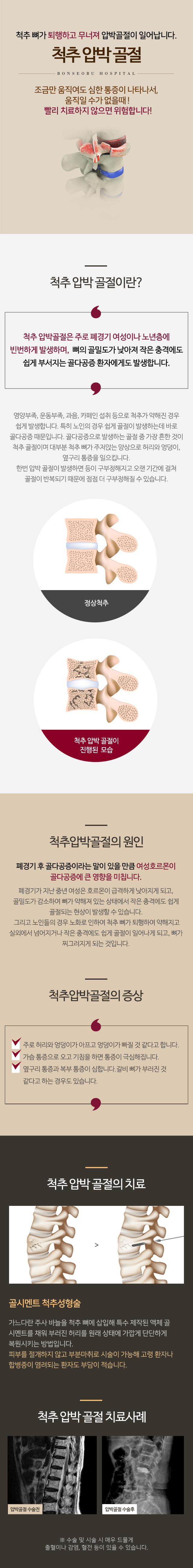 척추 압박 골절