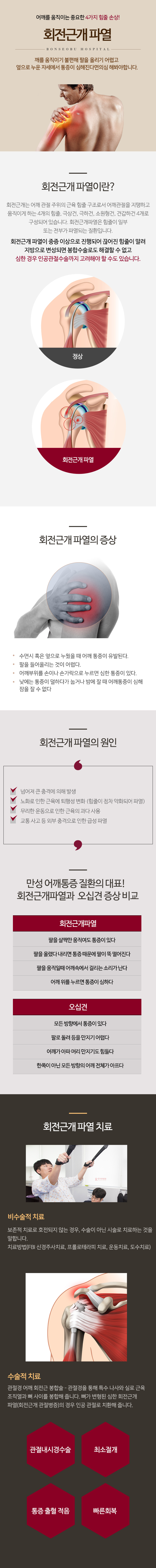 회전근개 파열