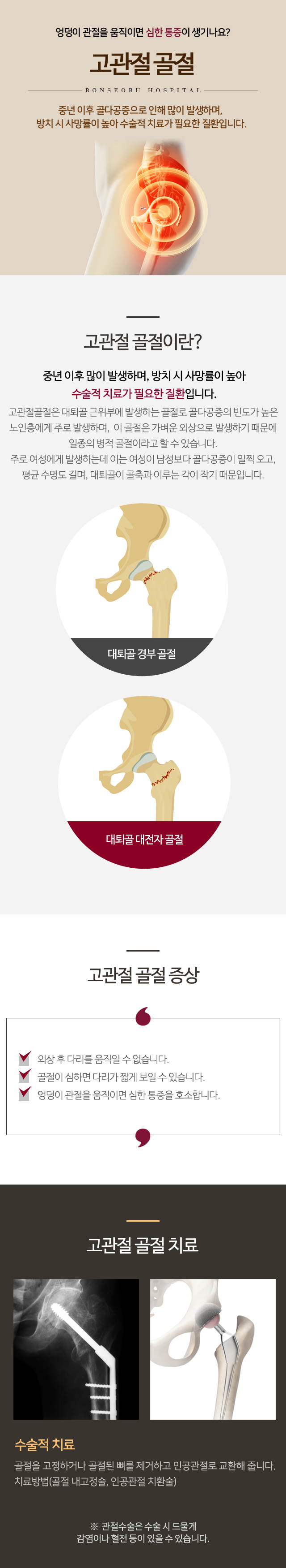 고관절 골절