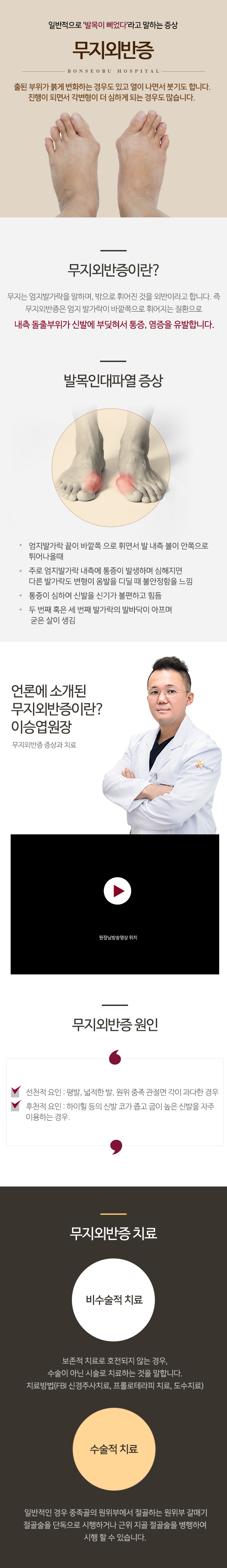 무지외반증