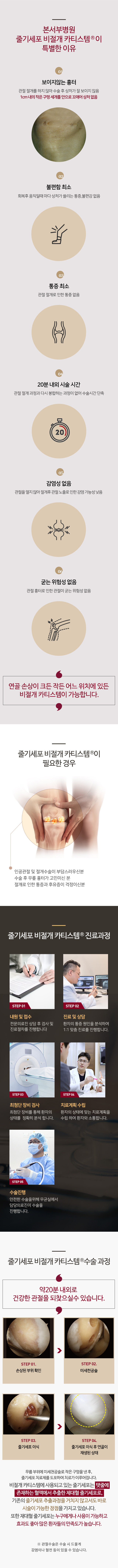 줄기세포 비절개 카티스템