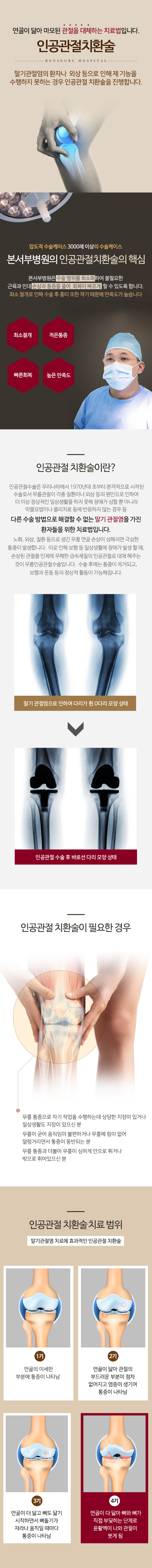 인공관절치환술